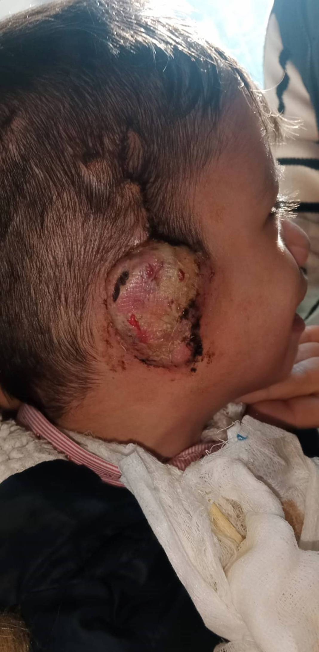 Ameliyat olan 4 yaşındaki çocuğun kulağı çürüdü! 'Operasyonlar güzel geçti diye bizi oyaladılar' 6